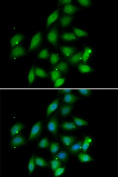 PPP2CA Antibody