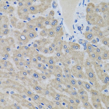 EIF2S3 Antibody