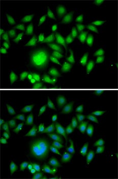 ATOH1 Antibody