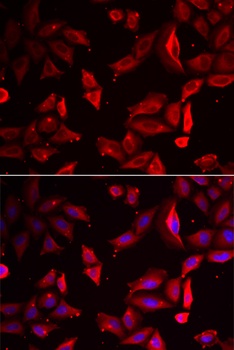 SERPINB9 Antibody