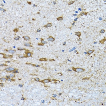 PDP1 Antibody