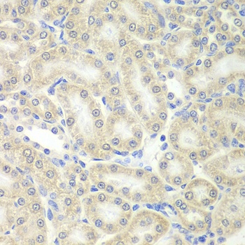 PRDX5 Antibody