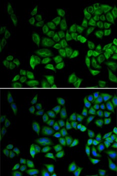 PRDX5 Antibody