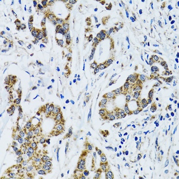 GAB1 Antibody