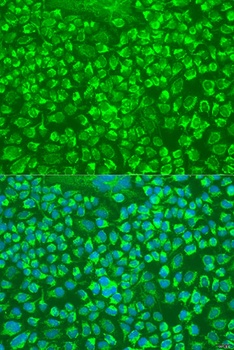 GZMA Antibody