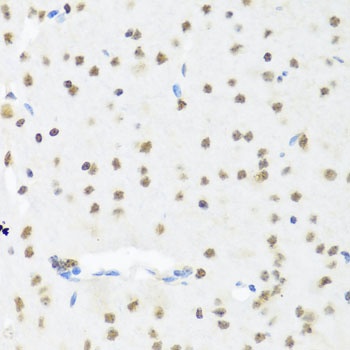 SET Antibody