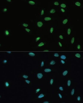 SET Antibody