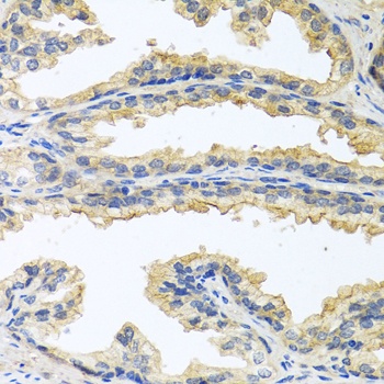 OSM Antibody