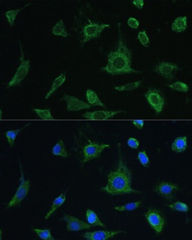 OSM Antibody