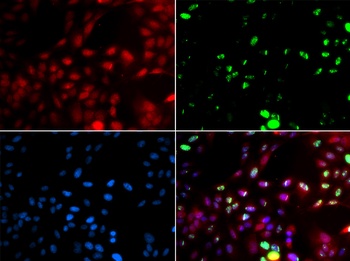 POLK Antibody