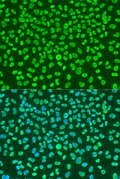 KHDRBS1 Antibody