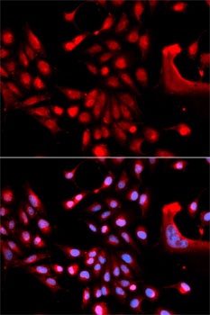 U2AF1 Antibody