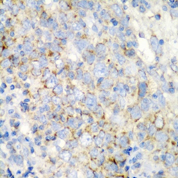 PRKCQ Antibody