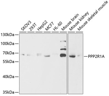 PPP2R1A Antibody