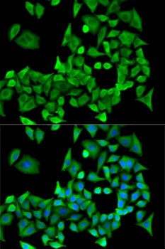 PPP2R1A Antibody