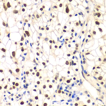 NFKBIB Antibody