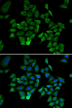 NFKBIB Antibody