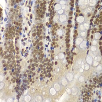 SMARCB1 Antibody