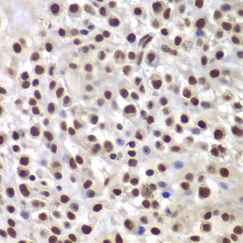 SMARCB1 Antibody