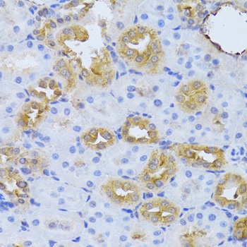 FDPS Antibody