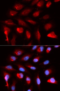 PPARD Antibody