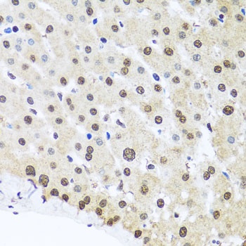 FUBP1 Antibody
