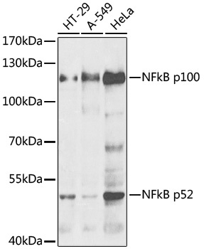 NFkB p100 / p52 Antibody