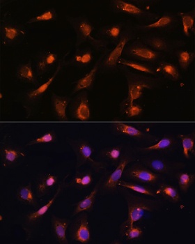 RIP3 Antibody