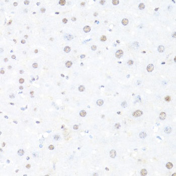 BACH1 Antibody