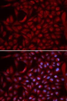 CUL5 Antibody