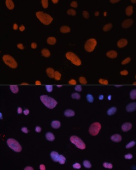 HDGF Antibody