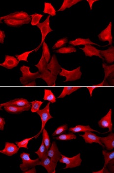 GCLM Antibody