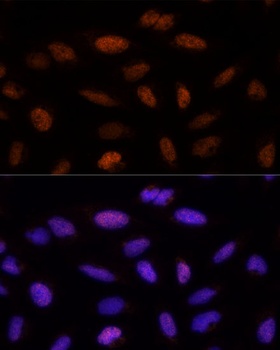 ADNP Antibody