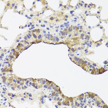 TOMM34 Antibody