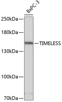 TIMELESS Antibody