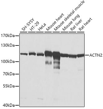 ACTN2 Antibody
