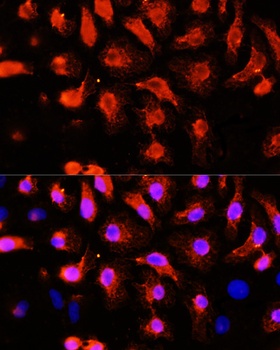 ACTN2 Antibody