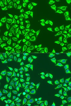 LRPPRC Antibody