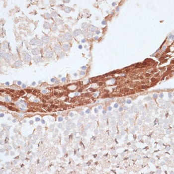 KIFC1 Antibody