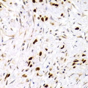 p53 Antibody
