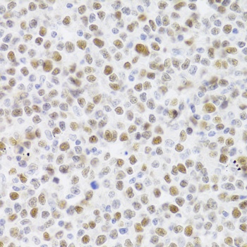 p53 Antibody