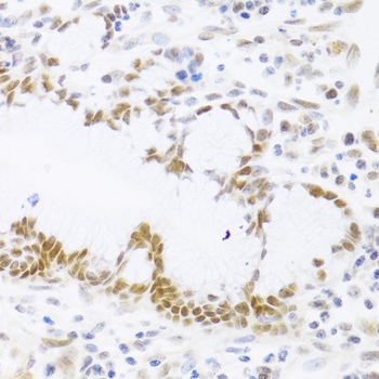 p53 Antibody