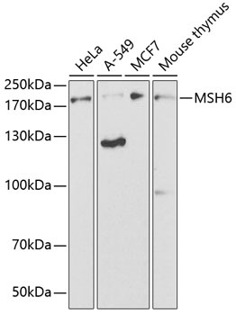 MSH6 Antibody