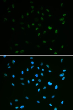 MSH6 Antibody
