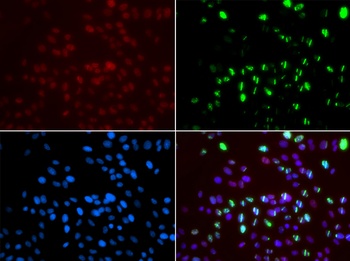 MSH6 Antibody