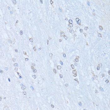 NFkB p100 / p52 Antibody