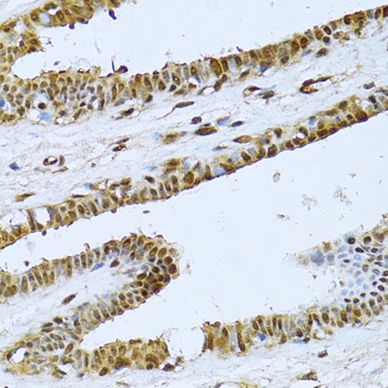 NFkB p100 / p52 Antibody