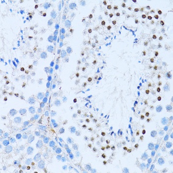 NFkB p100 / p52 Antibody