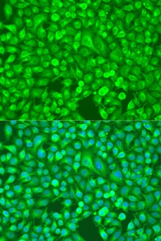 NFkB p100 / p52 Antibody