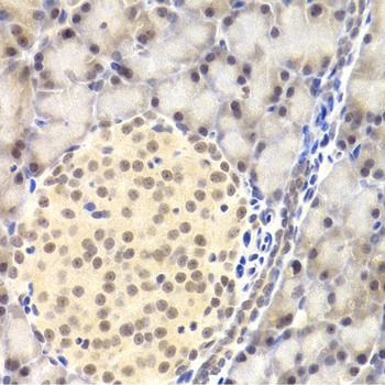PAWR Antibody